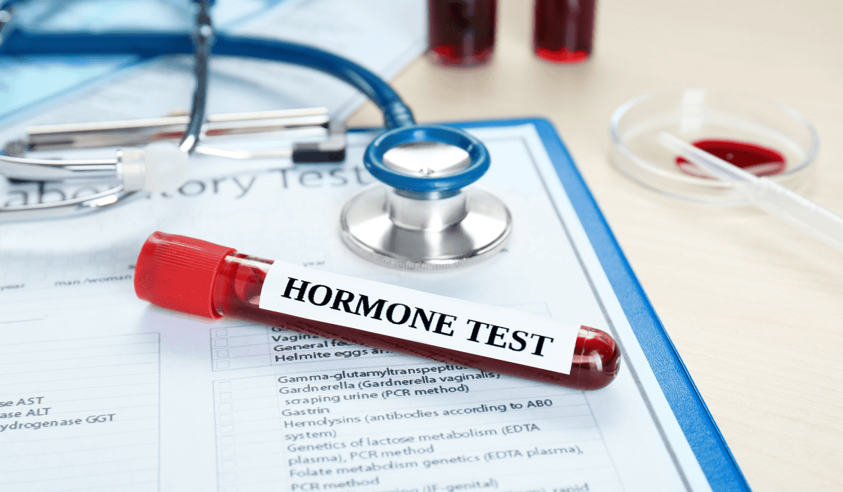 hormone test